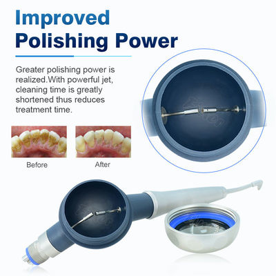 Do dente dental da terapia de Prophy Mate Teeth Cleaning Whitening Airpolishing do ar dos SS sistema de lustro