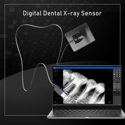 Sensor digital de raios-X dentário para implante dentário e tratamento endodôntico