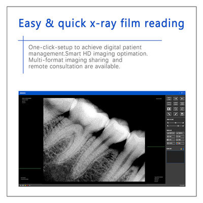 Sensor digital de raios-X dentário para implante dentário e tratamento endodôntico