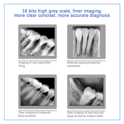 Sensor digital de raios-X dentário para implante dentário e tratamento endodôntico